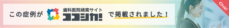 ココシカバナー
